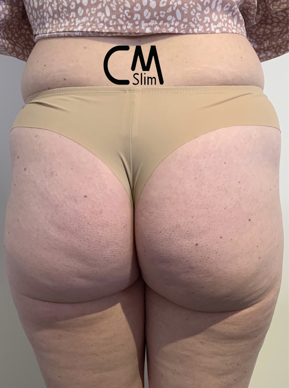 CM Slim Before